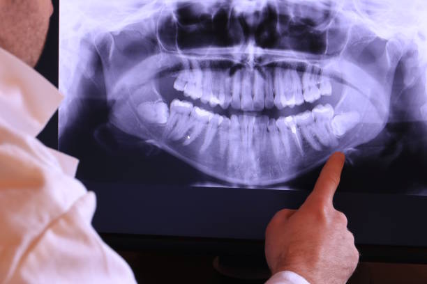 Best Emergency Dental Care for Broken or Chipped Teeth in St Ann, MO