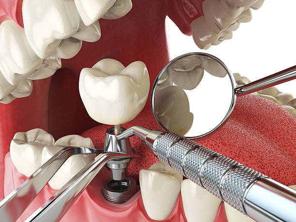 Best Cosmetic Emergency Dentistry in St Ann, MO